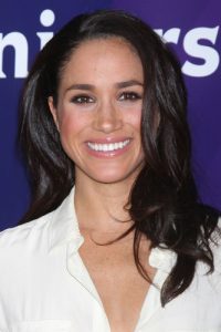 Meghan Markle teeth smile makeover