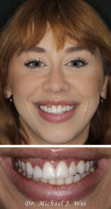 Brittany M Composite Before 540x1015